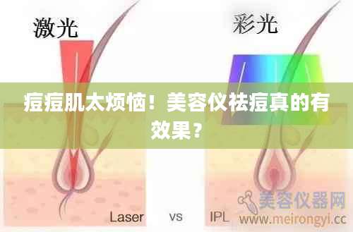 痘痘肌太烦恼！美容仪祛痘真的有效果？