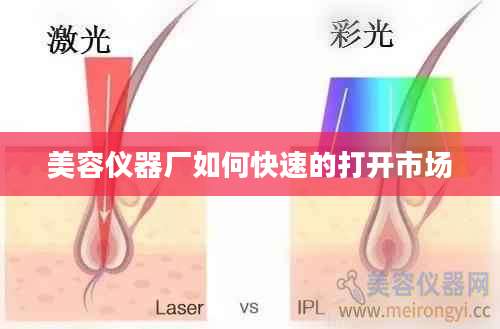 美容仪器厂如何快速的打开市场