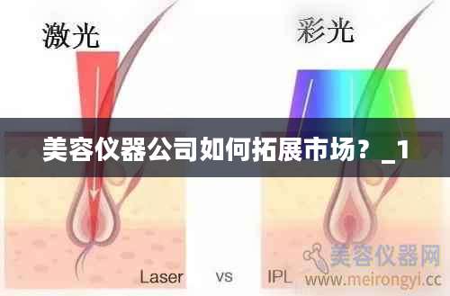 美容仪器公司如何拓展市场？_1