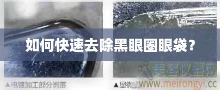 如何快速去除黑眼圈眼袋？
