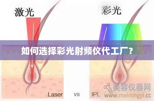 如何选择彩光射频仪代工厂？