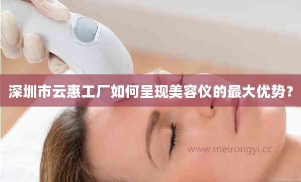 深圳市云惠工厂如何呈现美容仪的最大优势？