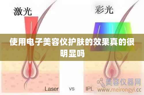 使用电子美容仪护肤的效果真的很明显吗