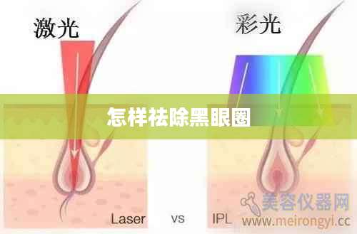 怎样祛除黑眼圈