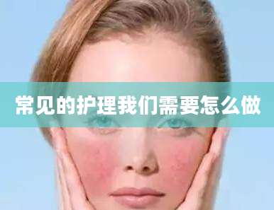 常见的护理我们需要怎么做