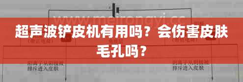 超声波铲皮机有用吗？会伤害皮肤毛孔吗？